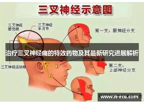 治疗三叉神经痛的特效药物及其最新研究进展解析